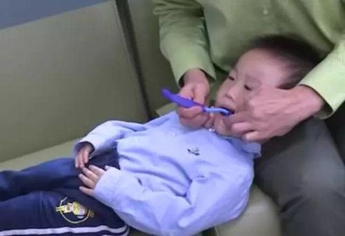 宝宝蛀牙视频,从视频看儿童口腔健康