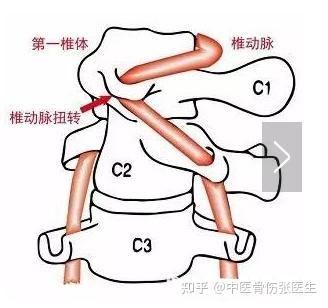 锻炼颈椎的视频,轻松缓解颈肩不适，恢复颈椎健康