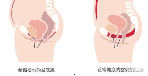 盆底肌修复视频,视频教程带你轻松恢复产后健康