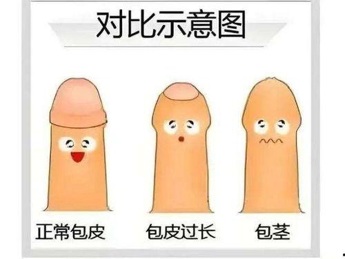 包茎手术视频,专业医生带你了解手术细节