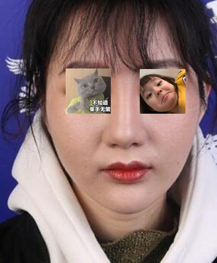 线雕大v脸全过程视频,轻松打造精致小脸术