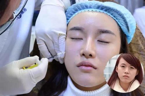 线雕大v脸全过程视频,轻松打造精致小脸术