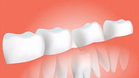 牙齿手术视频,专业视角下的牙科治疗实况