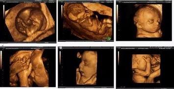 b超胎动视频,胎动视频见证宝宝成长瞬间