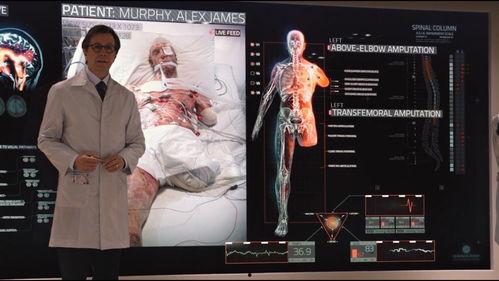 墨菲征视频,掌握诊断技巧的关键步骤