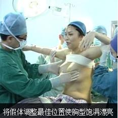 胸部手术视频,胸部手术操作步骤及要点解析